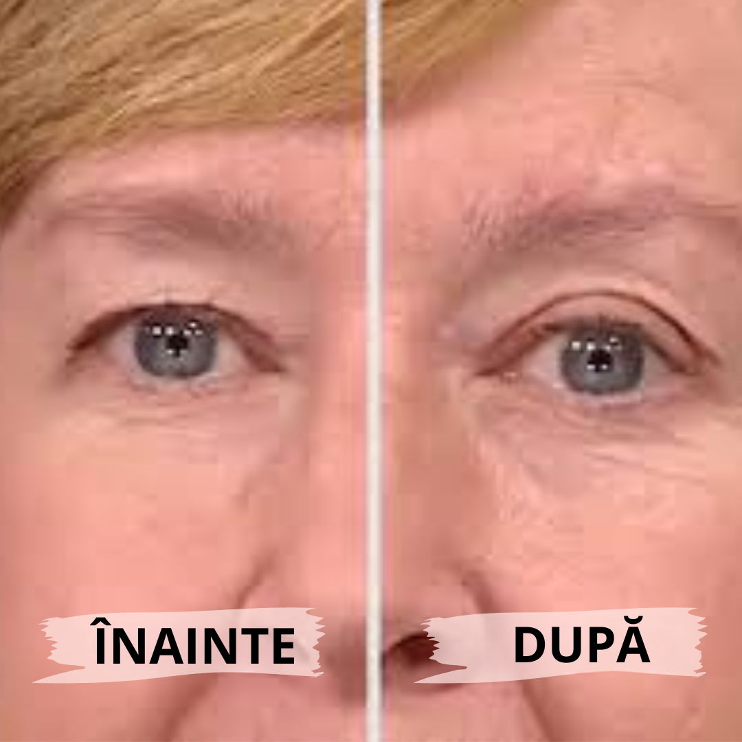Eyelid PushUp 🤩 Privire Instantanee ✨ 120 Perechi! 😱